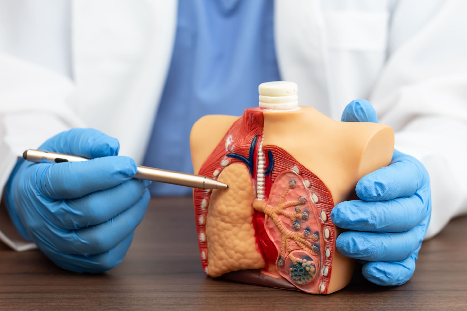 segmentectomia pulmonar o que é