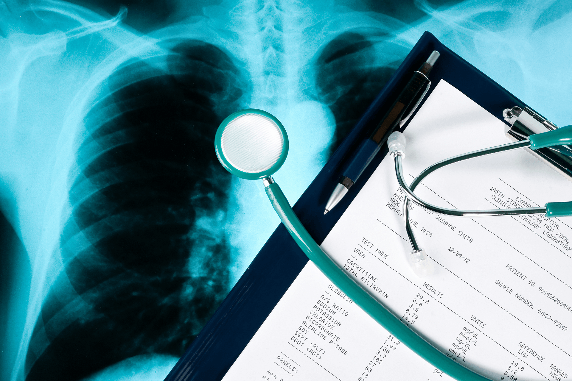 A stethoscope is sitting on top of a clipboard next to an x-ray