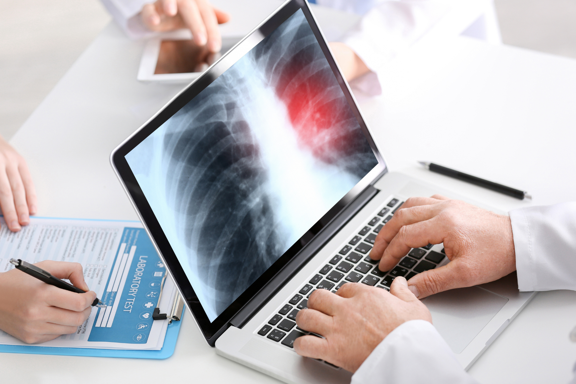 A doctor is looking at an x-ray on a laptop computer.