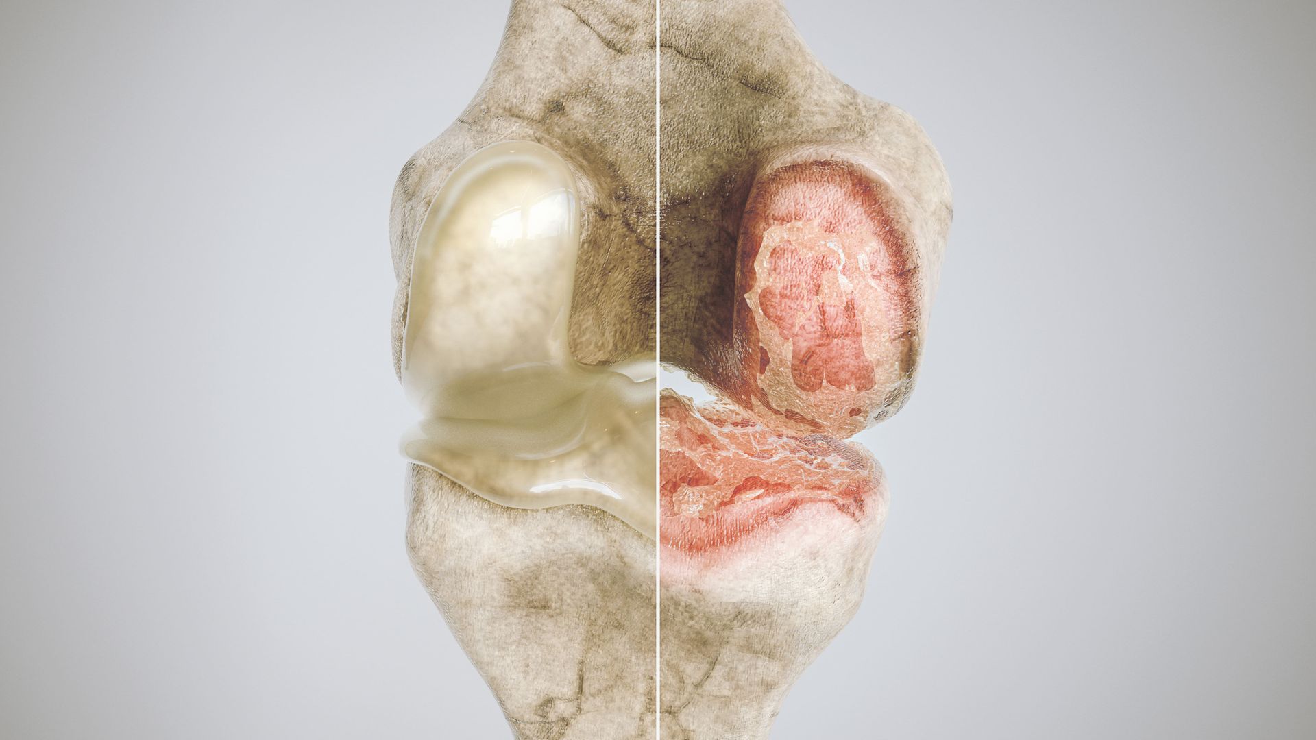 A close up of a knee joint before and after surgery.