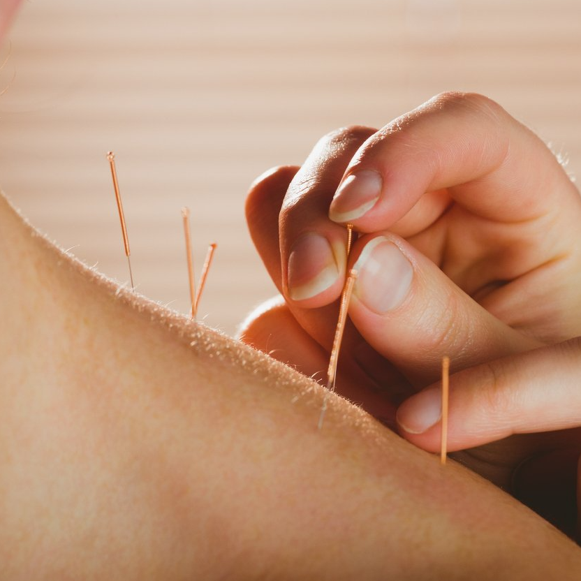 acupuncture services