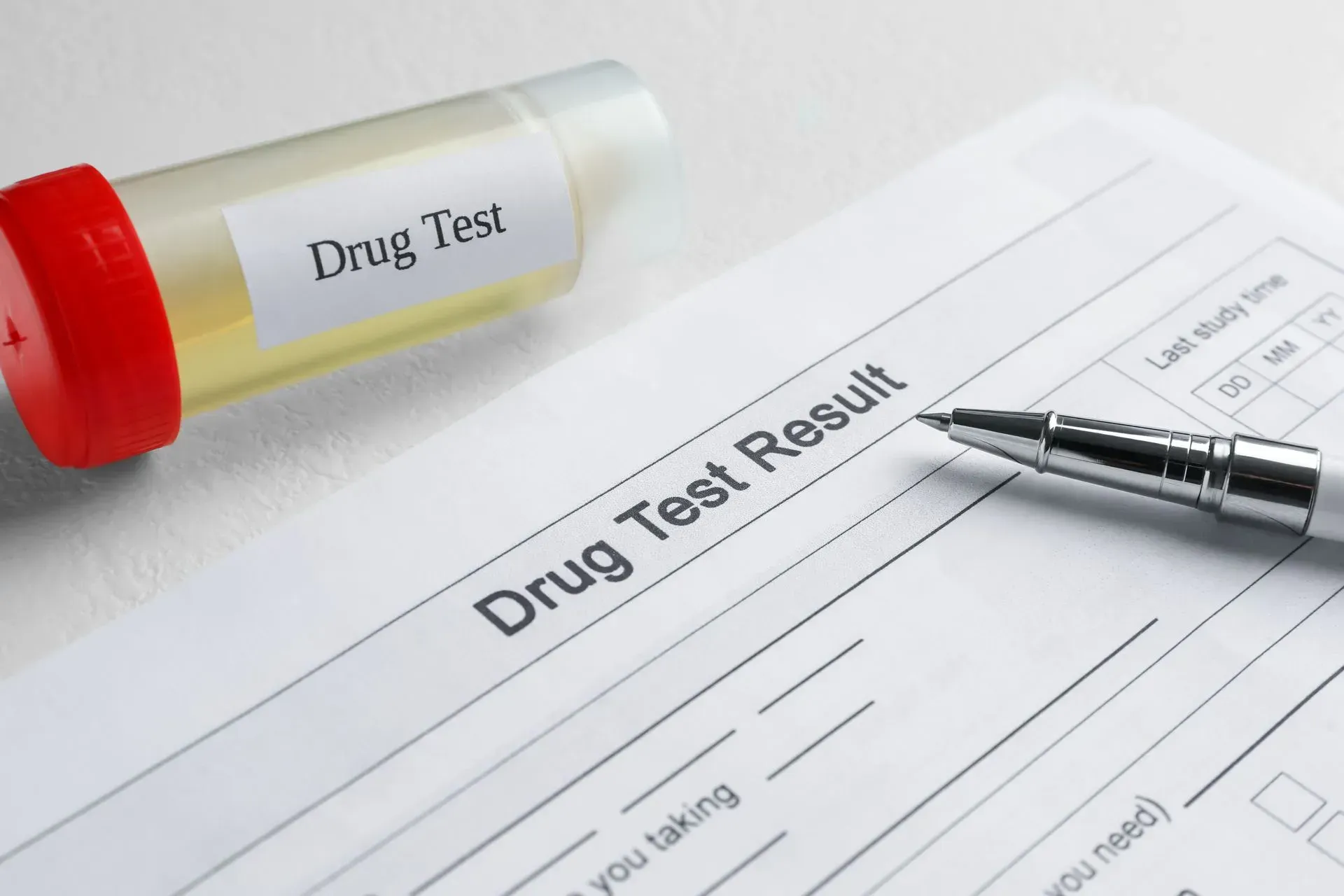 Drug test form, urine sample, and pen on a white surface, indicating a drug test result.