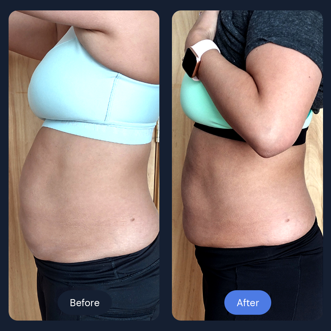 Side-by-side comparison of a person's midsection before and after a change, showing abdominal reduction.
