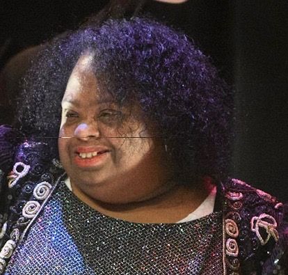 Babette joined the Arc’s Performing Arts Program in 1997.  She acquired  the nickname of “Our Diva”.  When Babette performed on stage, her charisma and talent brought the audiences  to their feet.  In 2008, she suffered a severe stroke which left her without speech and paralyzed  on her entire left side.  Her determination to perform on stage helped her be able to return to the stage.  Her wish was to be able to walk back on stage.  Although still in a wheel chair, we managed to make her wish come true with the help of two dancers providing support.  She continues to perform and can still bring the house down with Wings to Fly Dance Company.