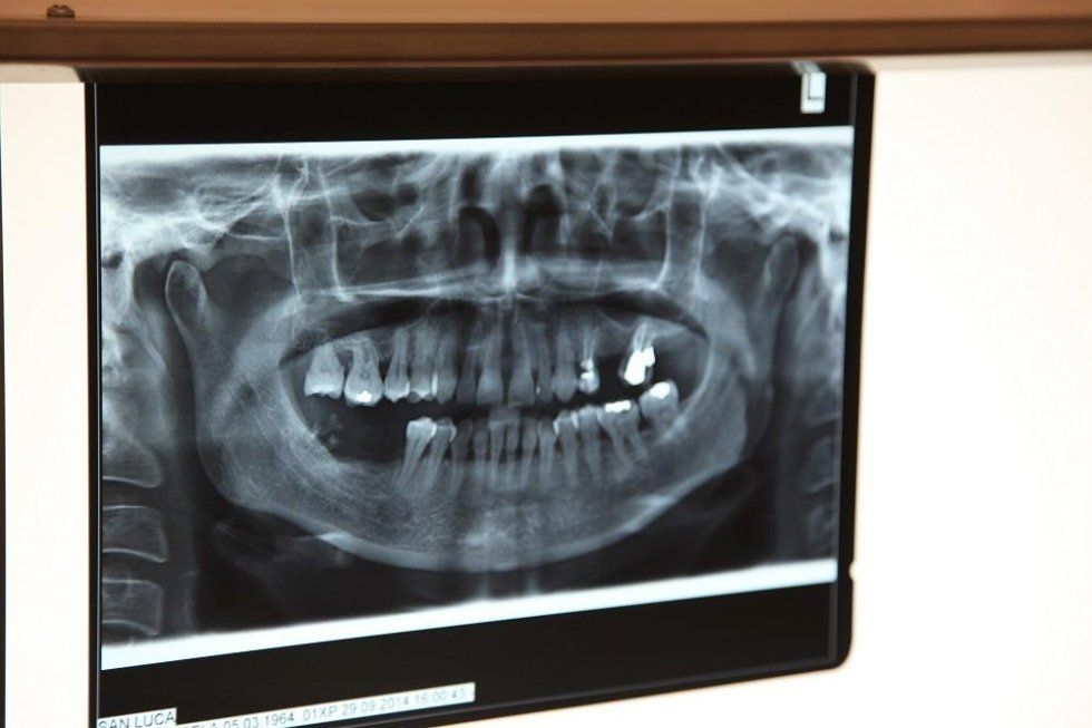 panoramica dentale