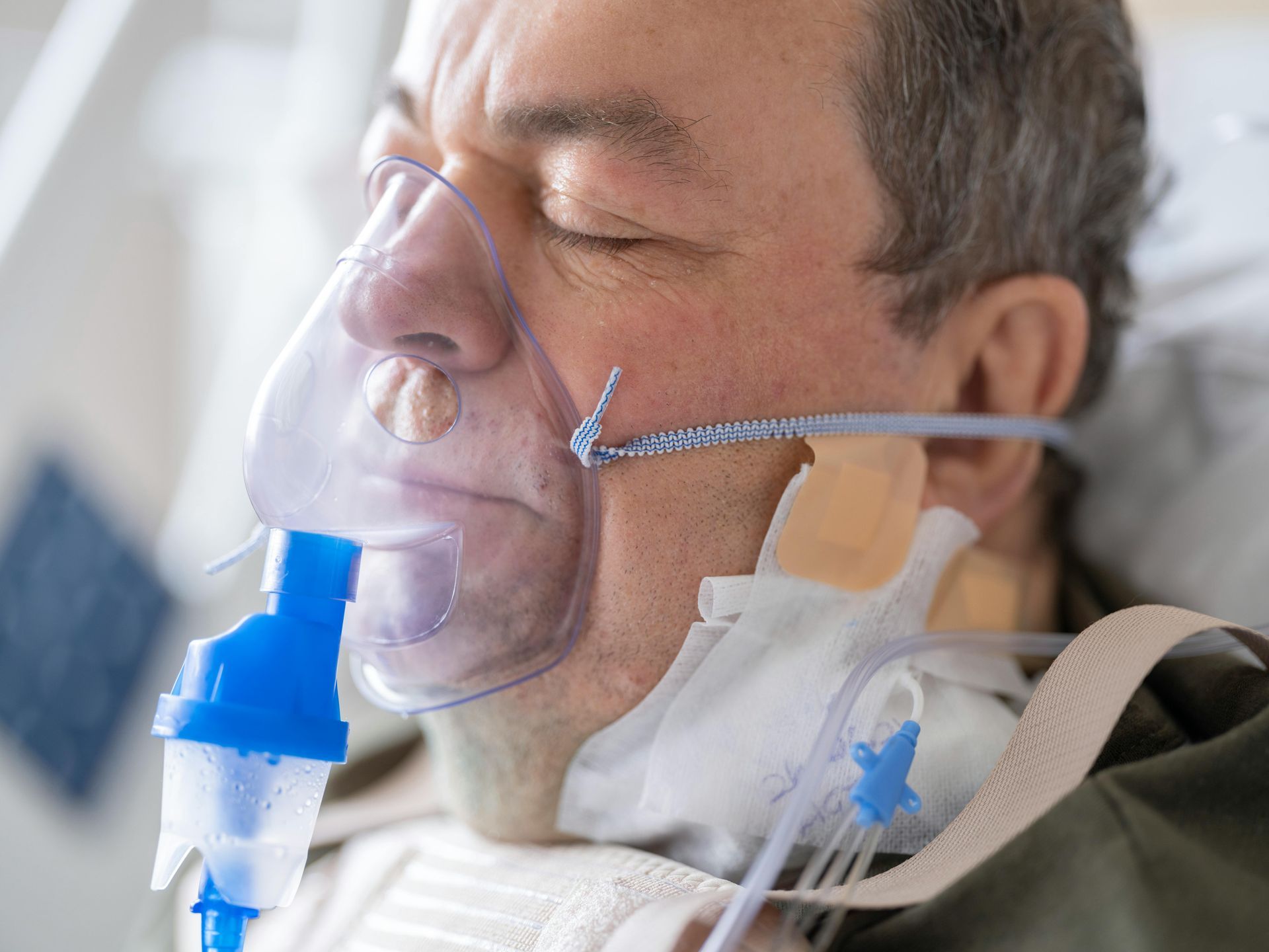 Severe Sepsis