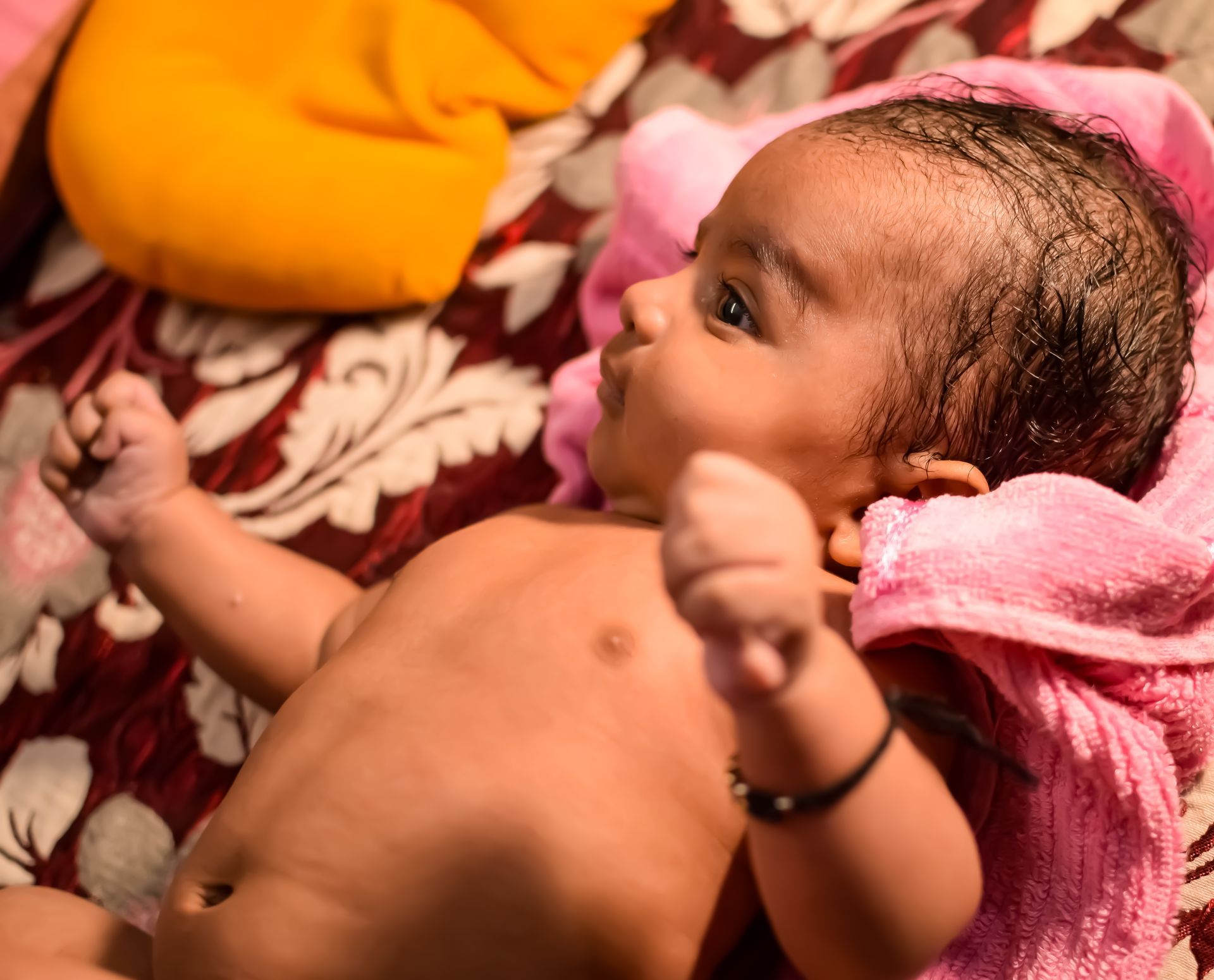 Newborn Jaundice