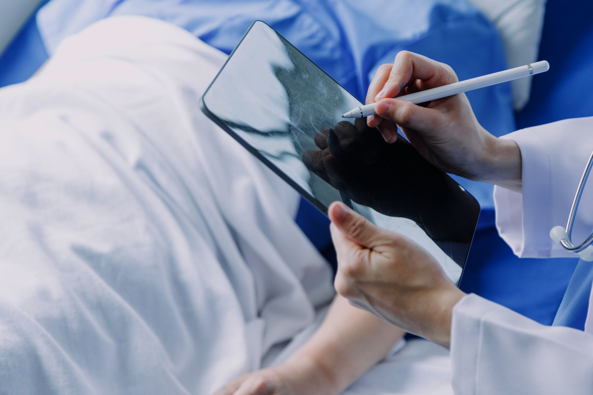 Post-Surgery Monitoring