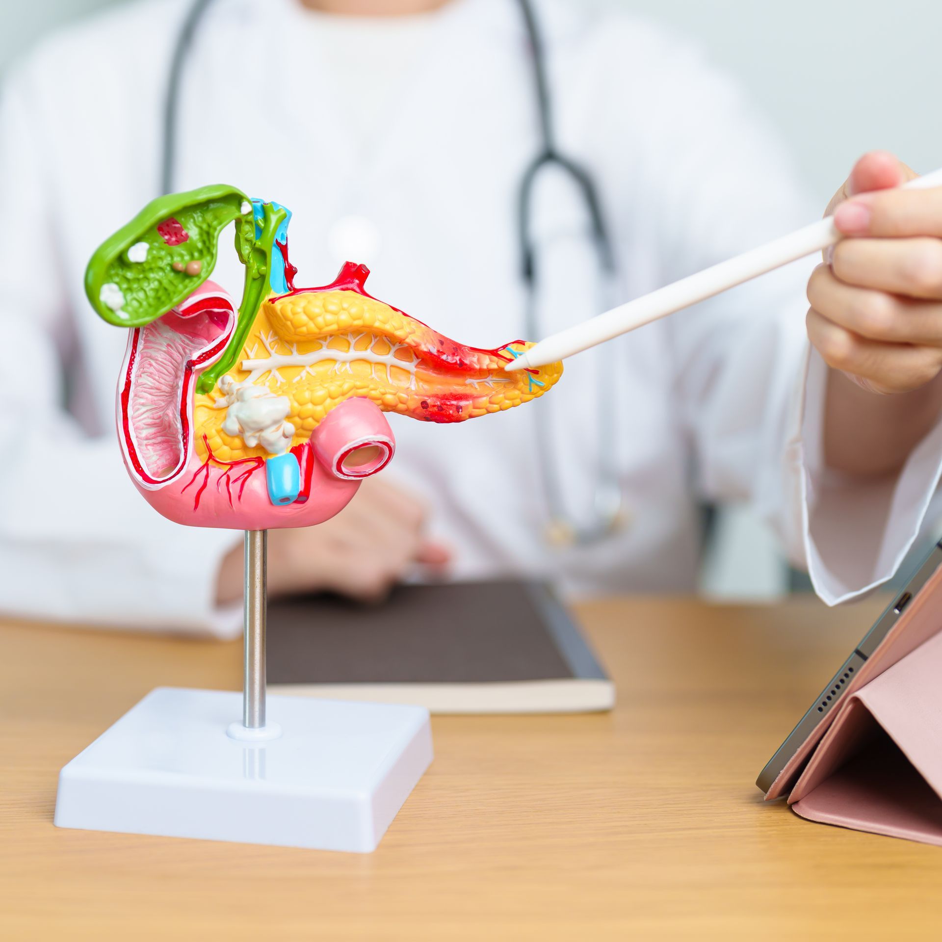 Acute Pancreatitis