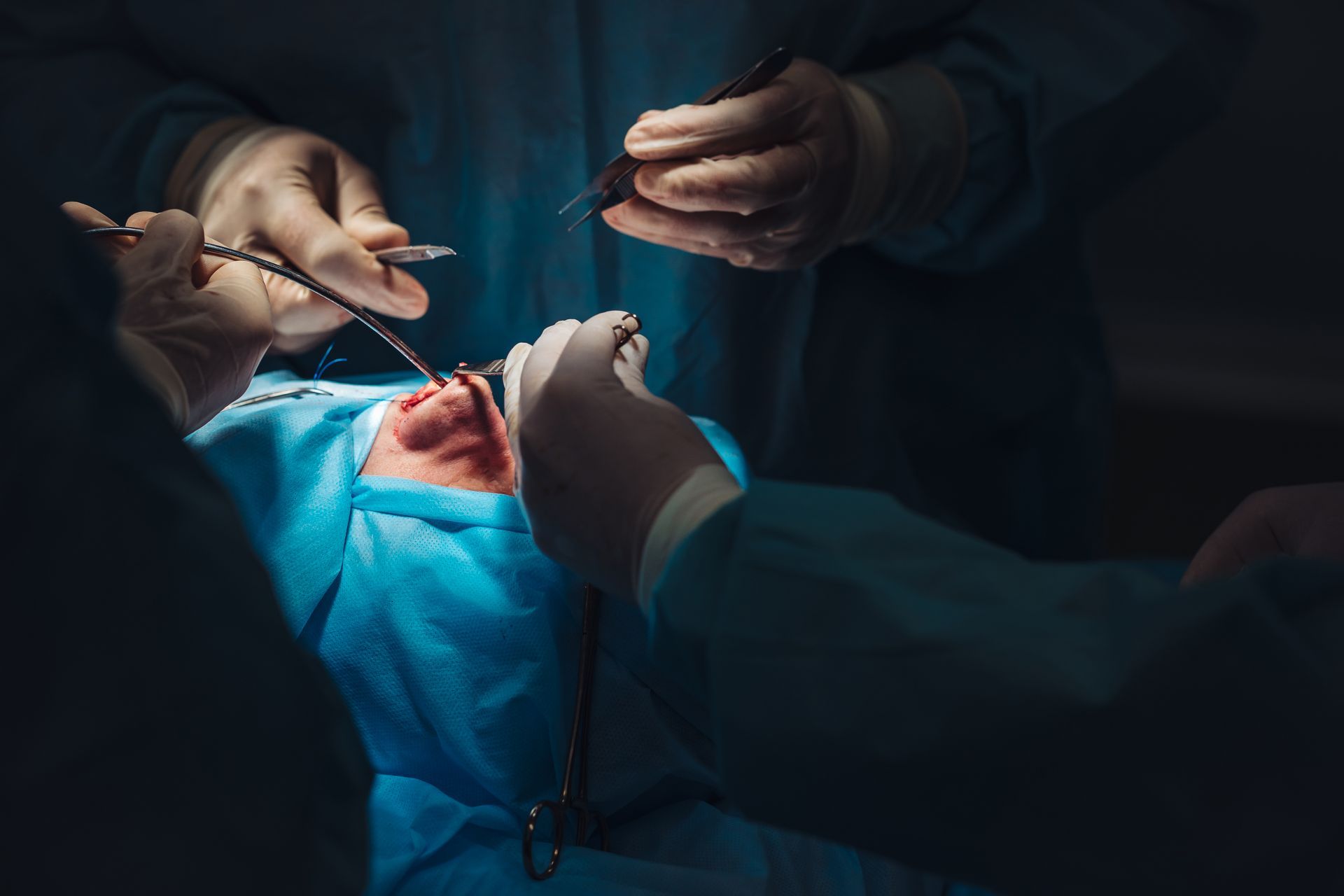 Wound Dehiscence