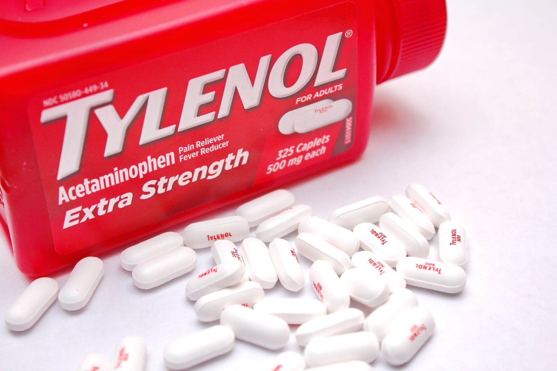 Acetaminophen Toxicity
