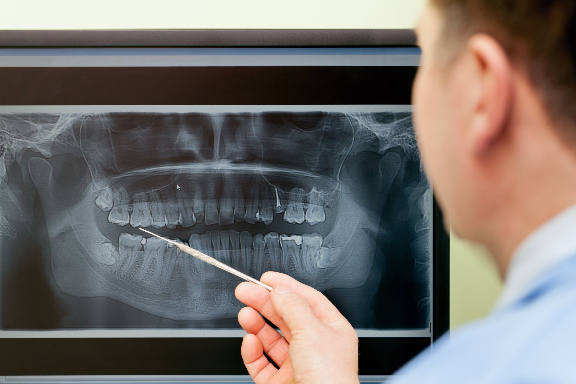 A dentist is looking at an x-ray of a person 's teeth.