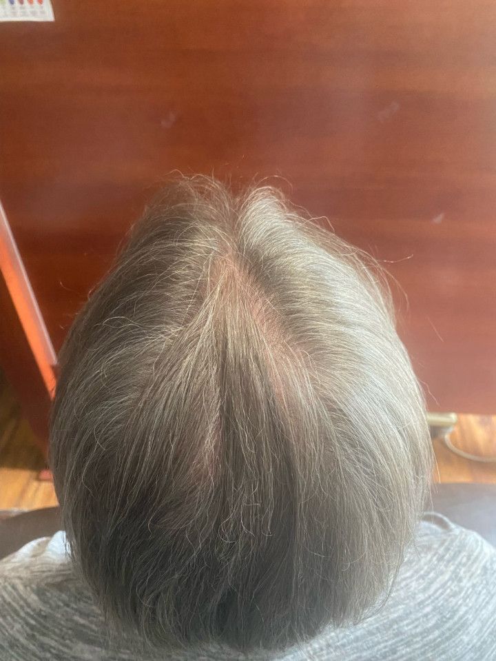 A close up of a person 's head with gray hair.