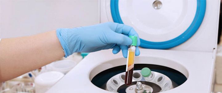 A person is holding a pipette over a centrifuge.