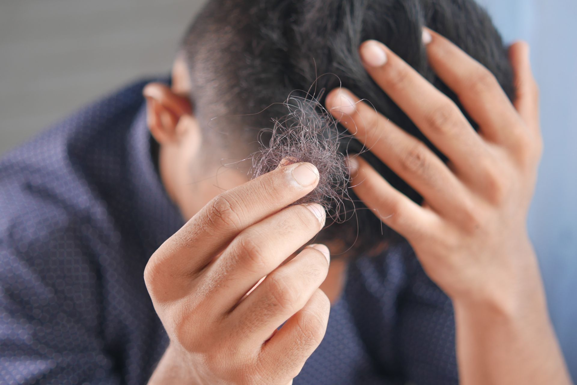 Exploring Causes and Remedies for Hair Loss