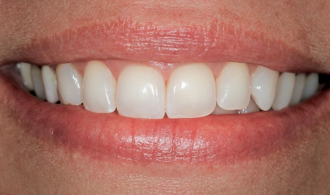 Brush Dental Studio Premier Dentist in Saint Bonifacius, MN