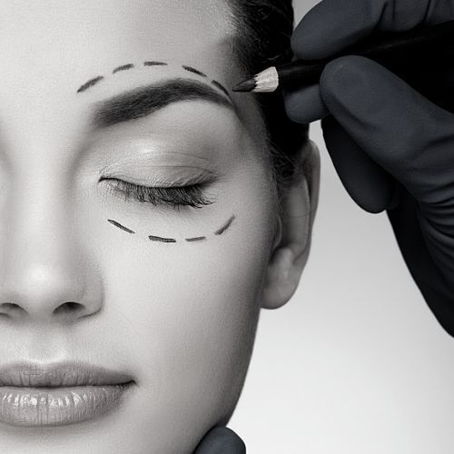 Pretoria Plastic Surgery - Eyelid surgery - Dr Ehren Eksteen