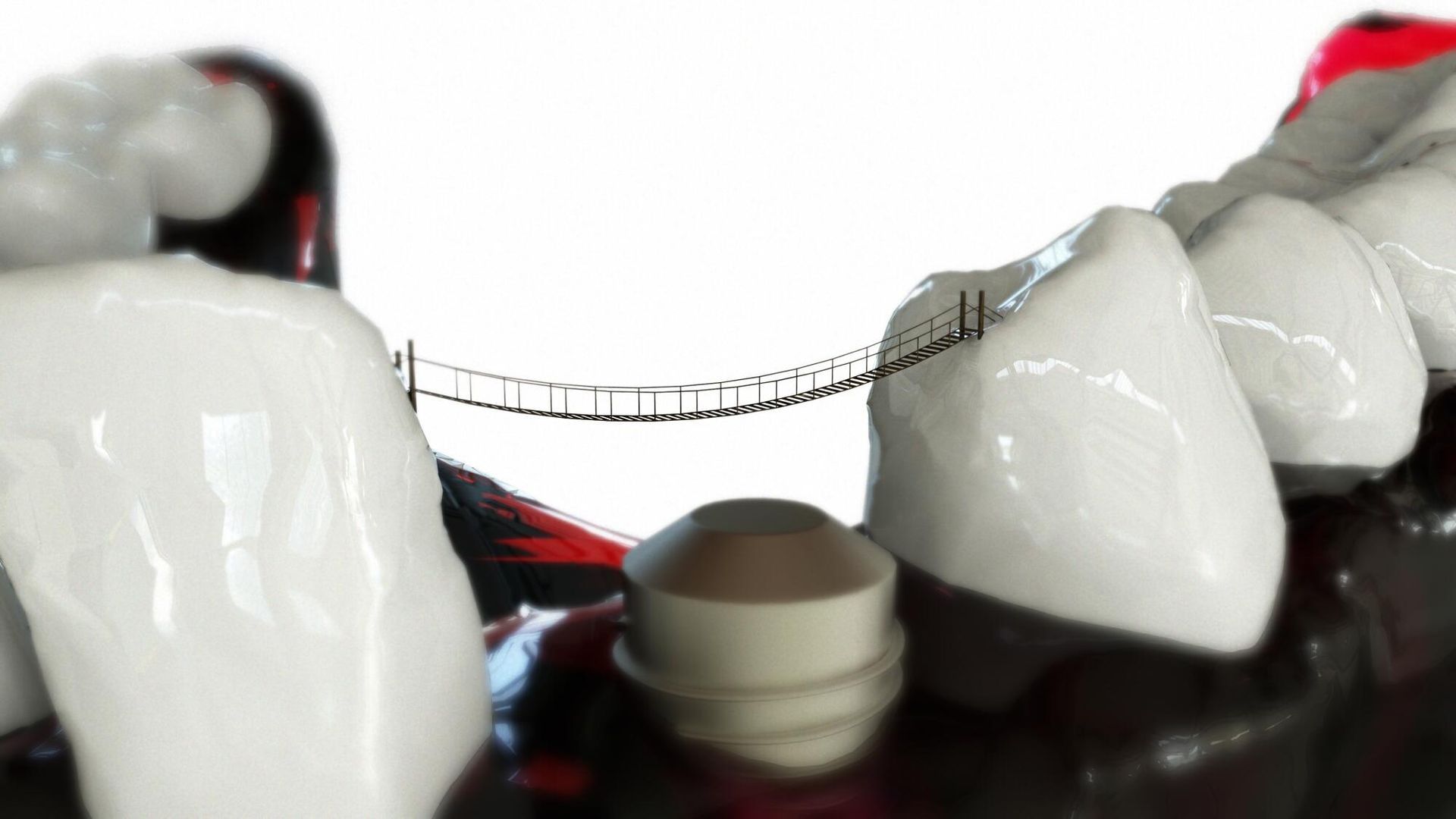 Braces model with clear wire between white teeth on a dental display