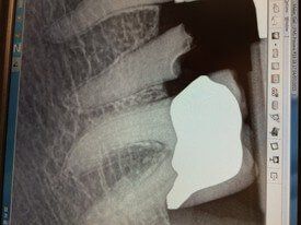 dental implant x-rays before