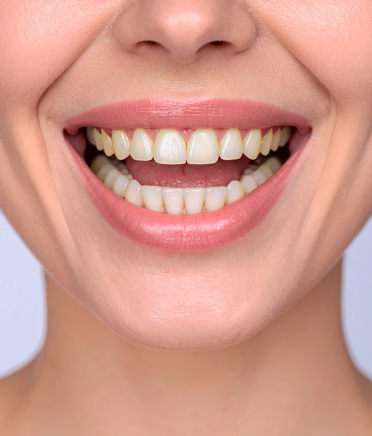 A close up of a woman 's smile with white teeth and pink lips.