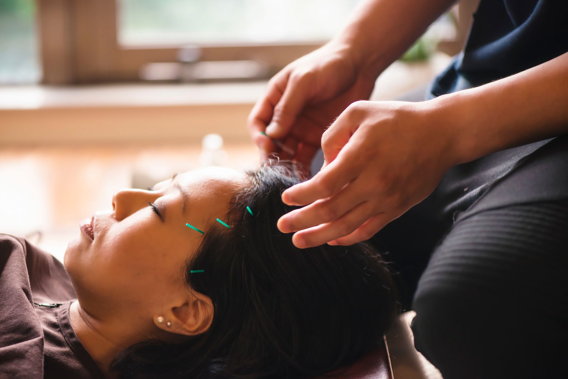 Acupuncture Therapy — Knoxville, TN — Deep River Wellness Center