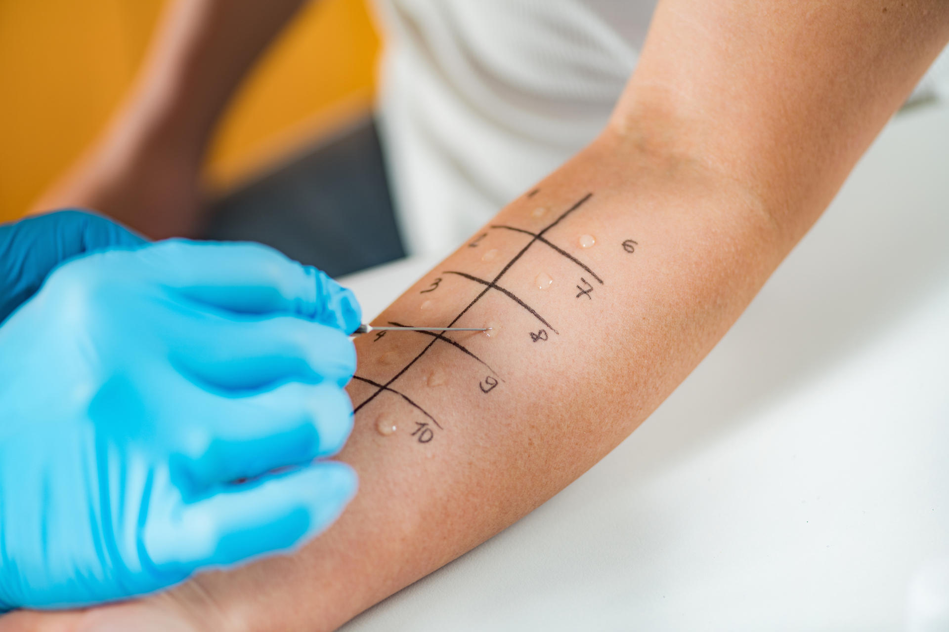 Expert clinical food allergy testing is done by the experts at Advanced Allergy and Asthma Care.