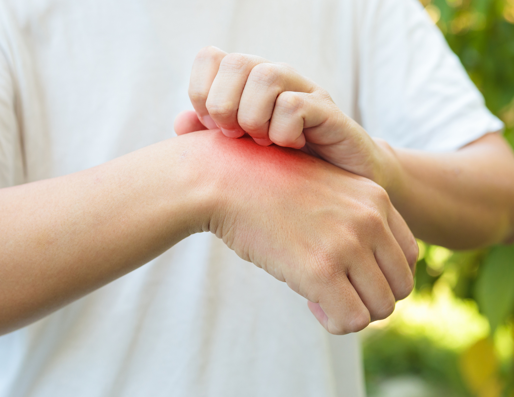 insect allergy testing