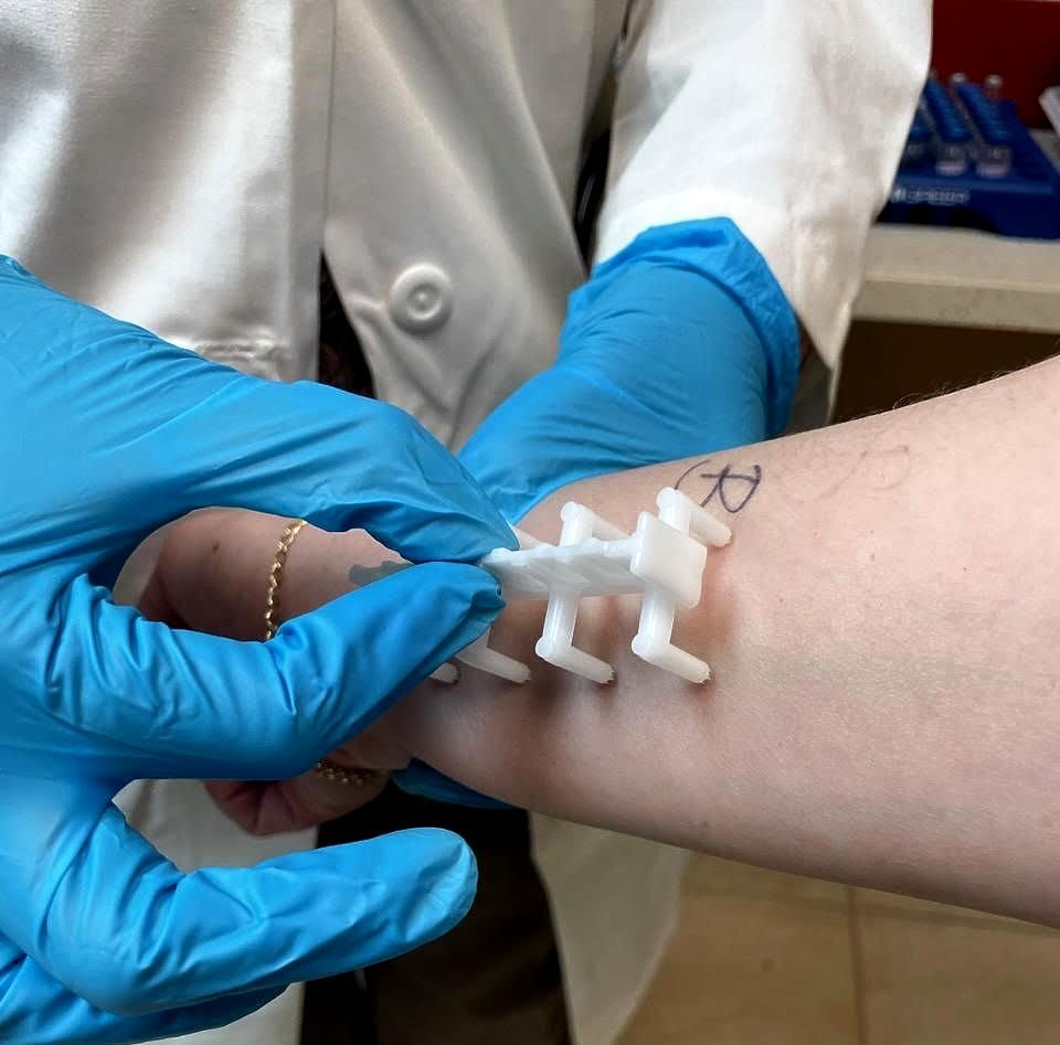 allergy skin testing