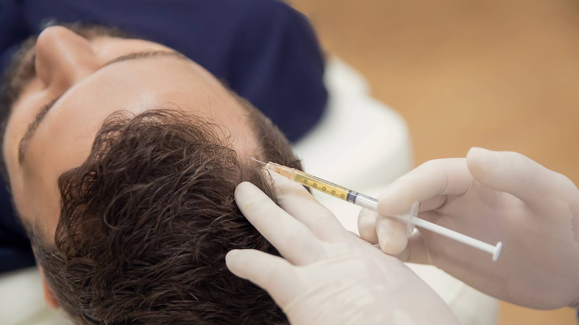 A patient receiving a platelet-rich plasma PRP procedure near Lexington, Kentucky (KY)