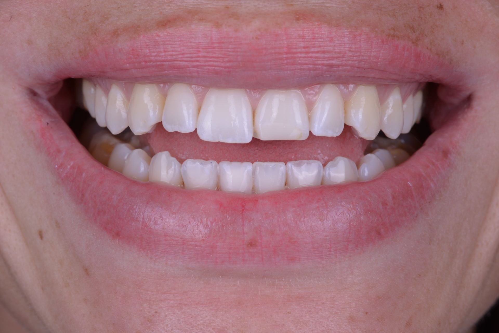 Miami Beach Dental Solutions