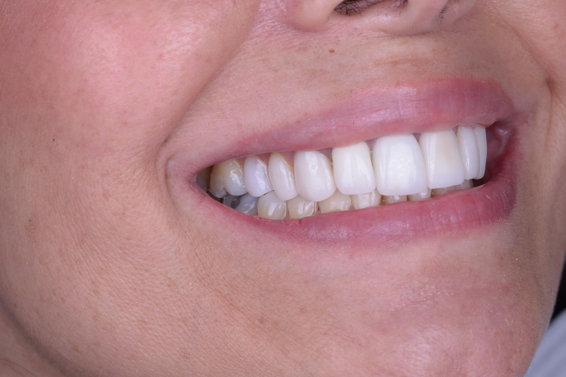 Miami Beach Dental Solutions