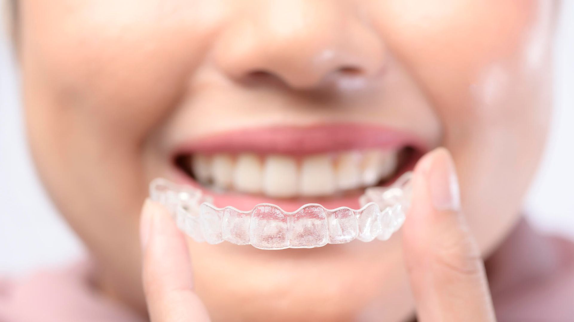 A woman is wearing a clear brace on her teeth.