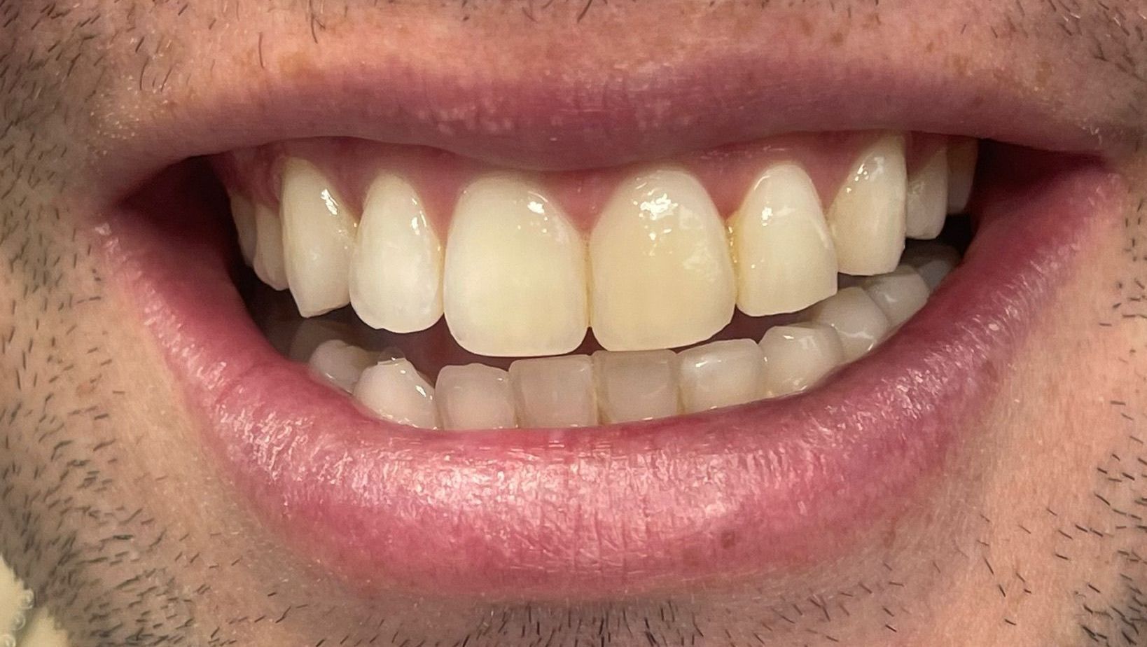 Miami Beach Dental Solutions