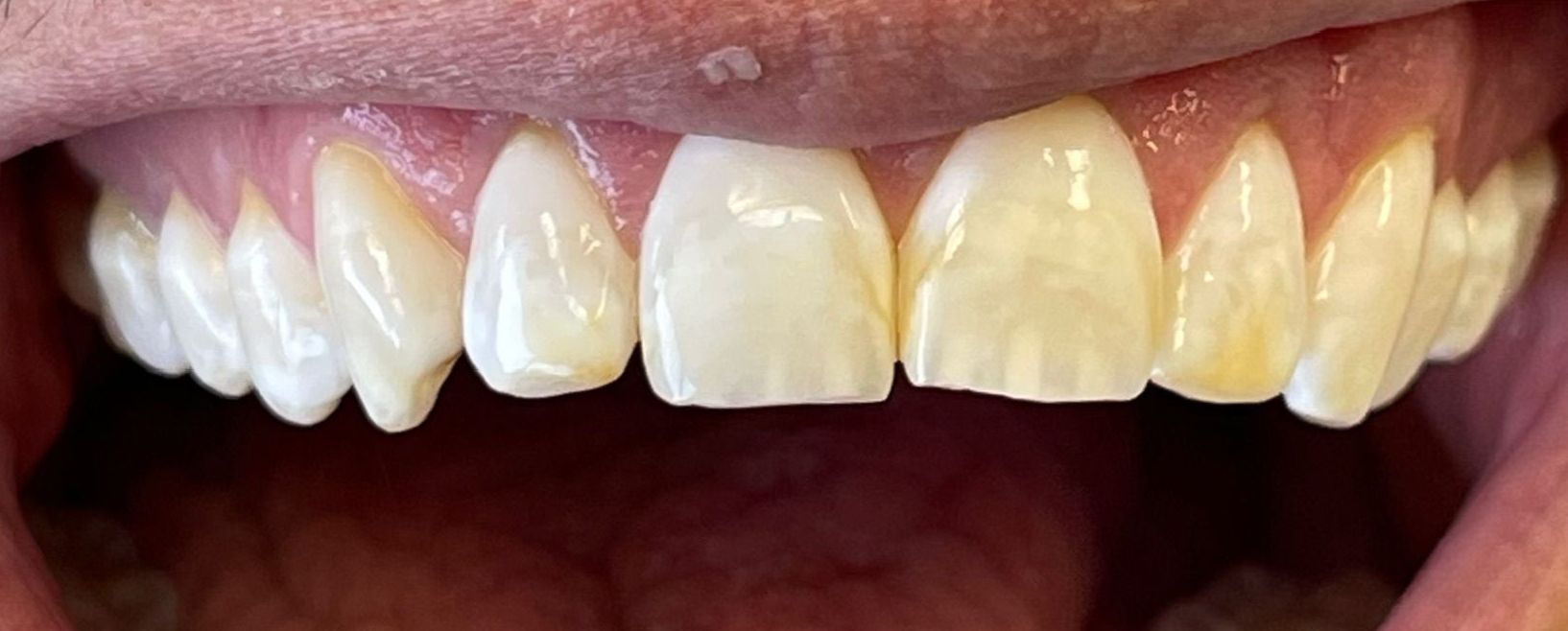 Miami Beach Dental Solutions