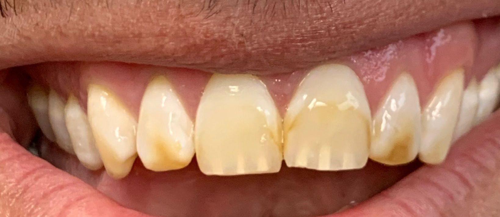 Miami Beach Dental Solutions