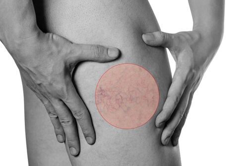 trattamento muscolo-scheletrico