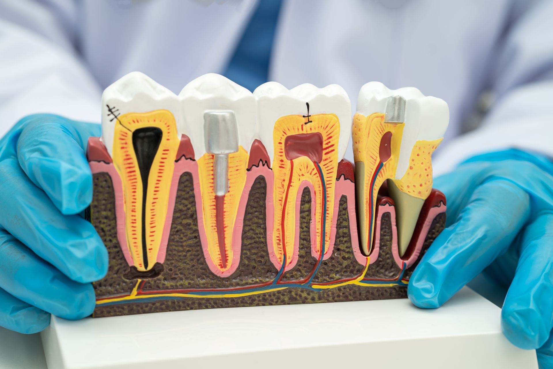 A dentist is holding a model of a tooth in his hands.