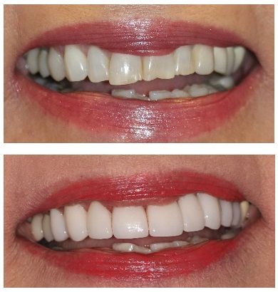 before and after dental in tucson az
