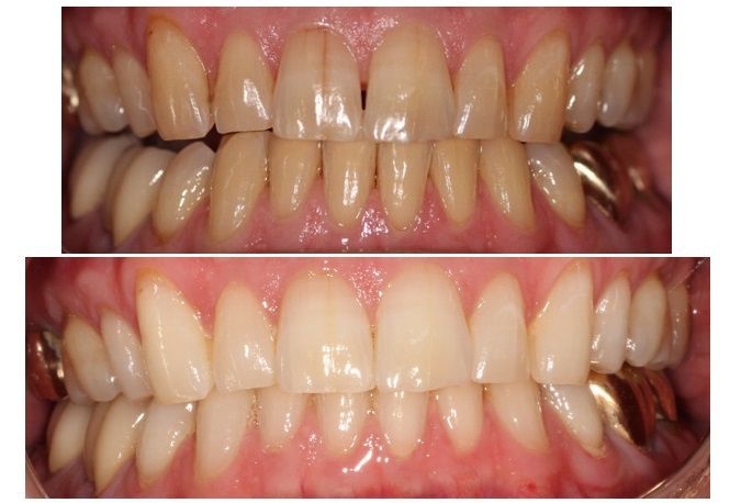 before and after dental in tucson az