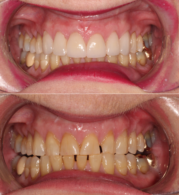 before and after dental in tucson az