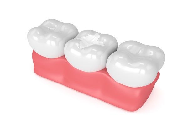 digital image of three teeth