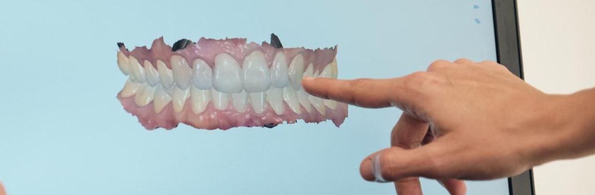 modern denture technology for young adults