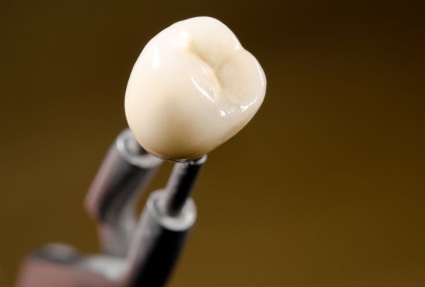 Is a Dental Crown Really Necessary? Four Questions to Ask Your Dentist
