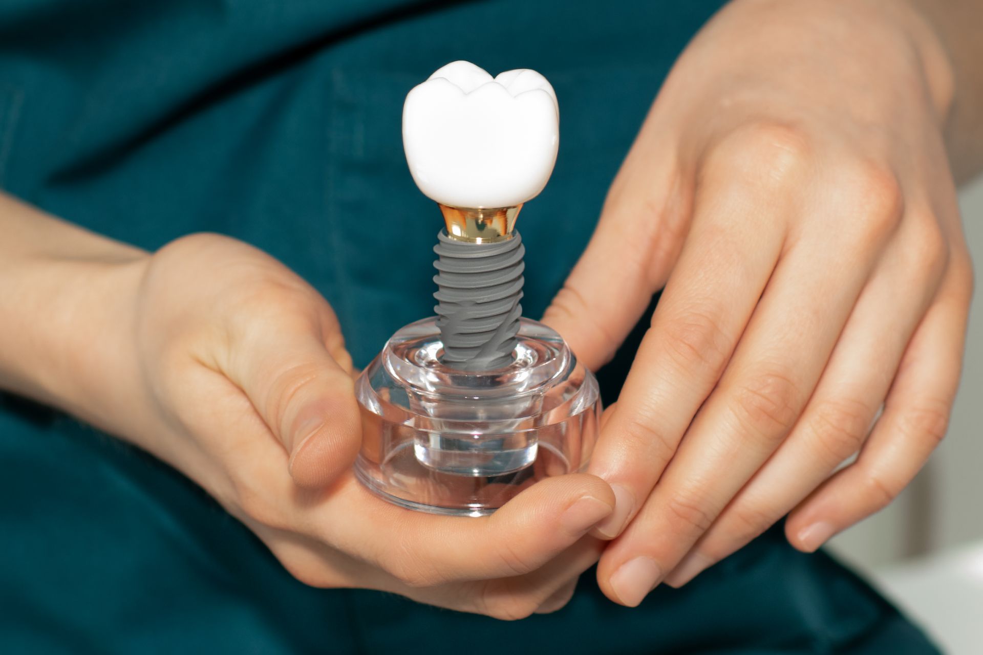 Hands holding a model of a dental implant: a white crown, gold connector, and gray screw in a clear holder.