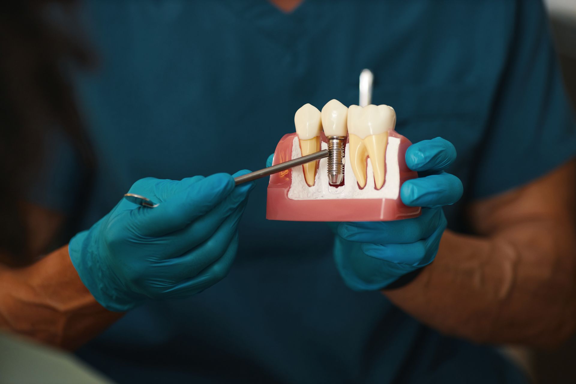 Gloved hands holding a dental model with a tool pointing at a tooth implant