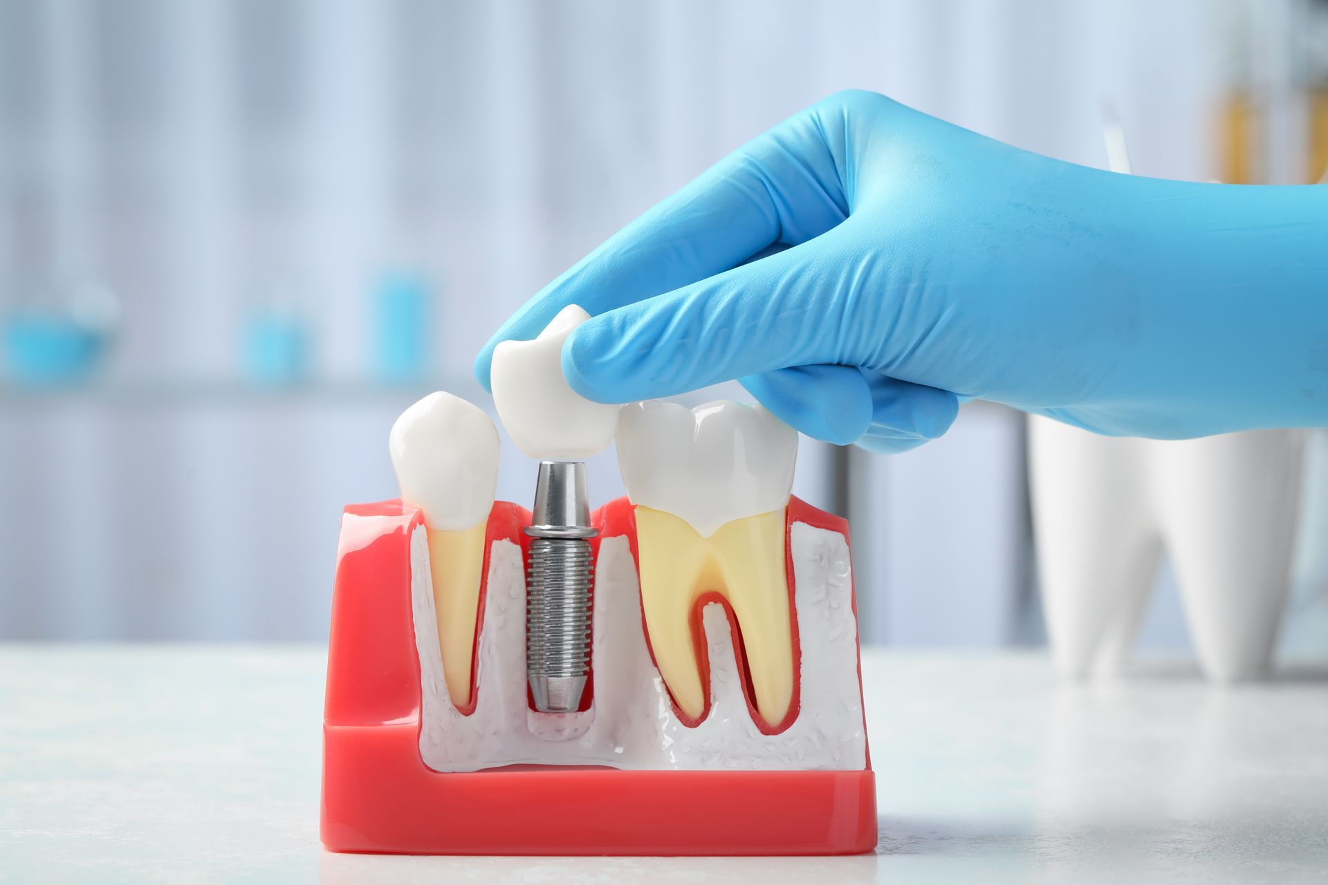 A gloved hand places a dental crown onto an implant model set in a red gum base, shown in a clinical setting.