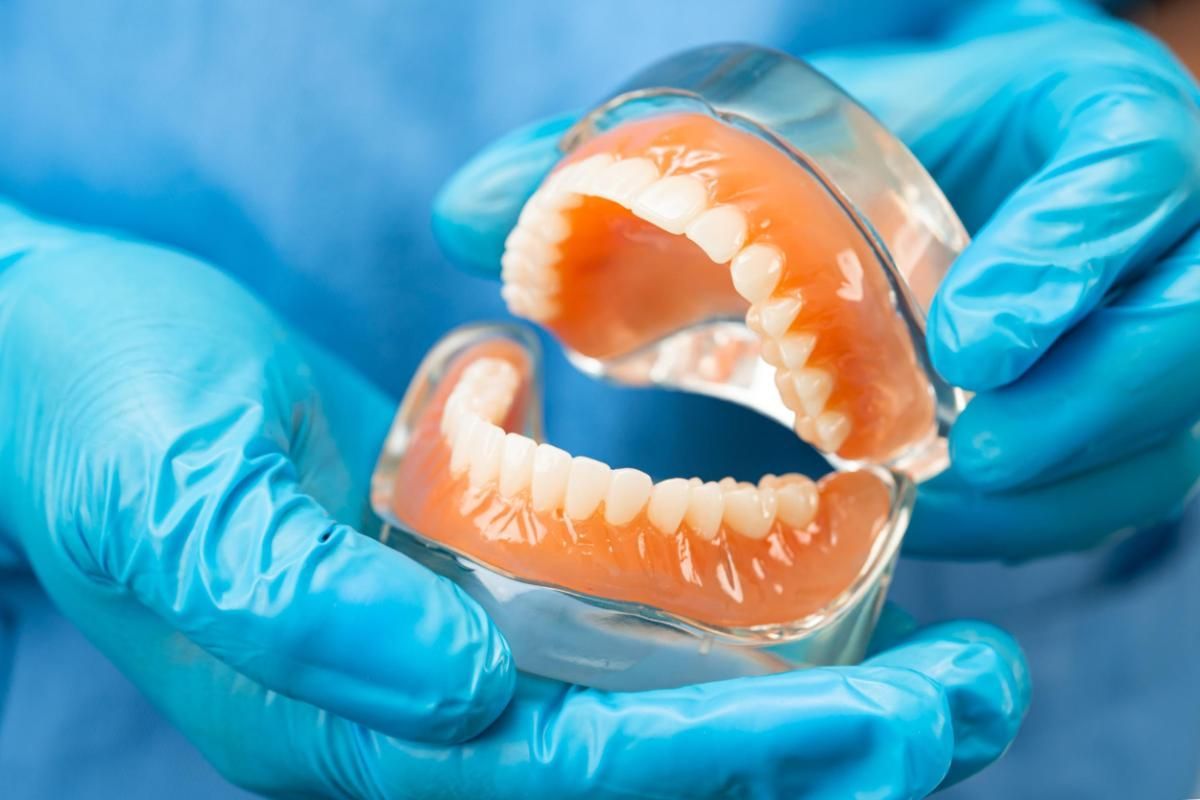 Denture, dentist holding dental teeth model to understand permanent procedures