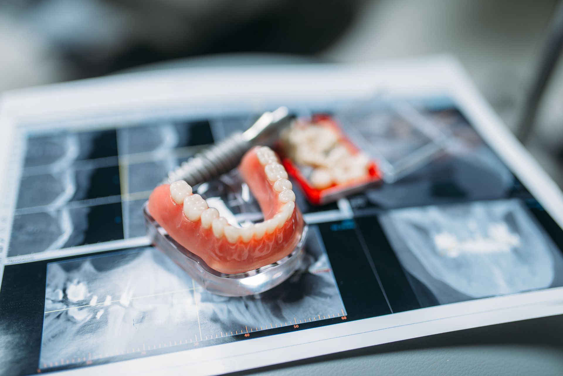 Dentures and dental tools on an X-ray film, a dental practice setting.