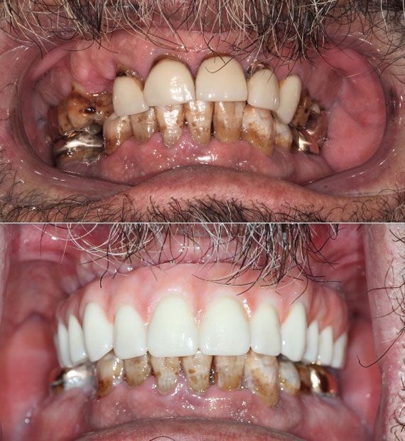 before and after dental in tucson az