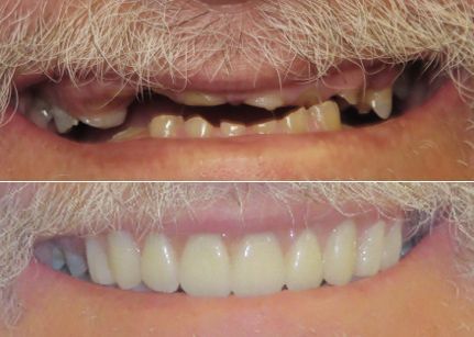 before and after dental in tucson az